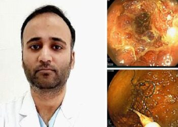 Advanced Endoscopic Technique Saves Life Of A Cancer Patient At Paras Health Srinagar