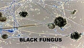 Centre asks States, UTs to make ‘black fungus’ notifiable disease under Epidemic Act