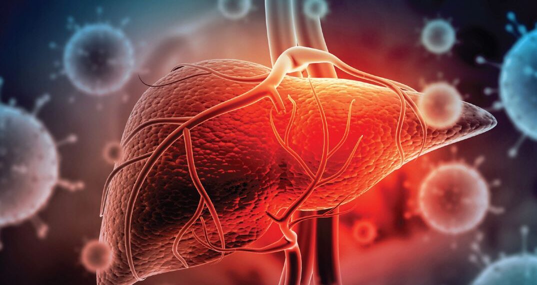 2 Children died of Hepatitis-A in Kulgam’s Turka Tachloo village creates panic