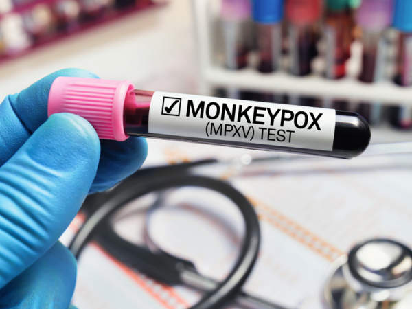 Union Health Secy Issues Advisory on Mpox: No Cases in India Yet