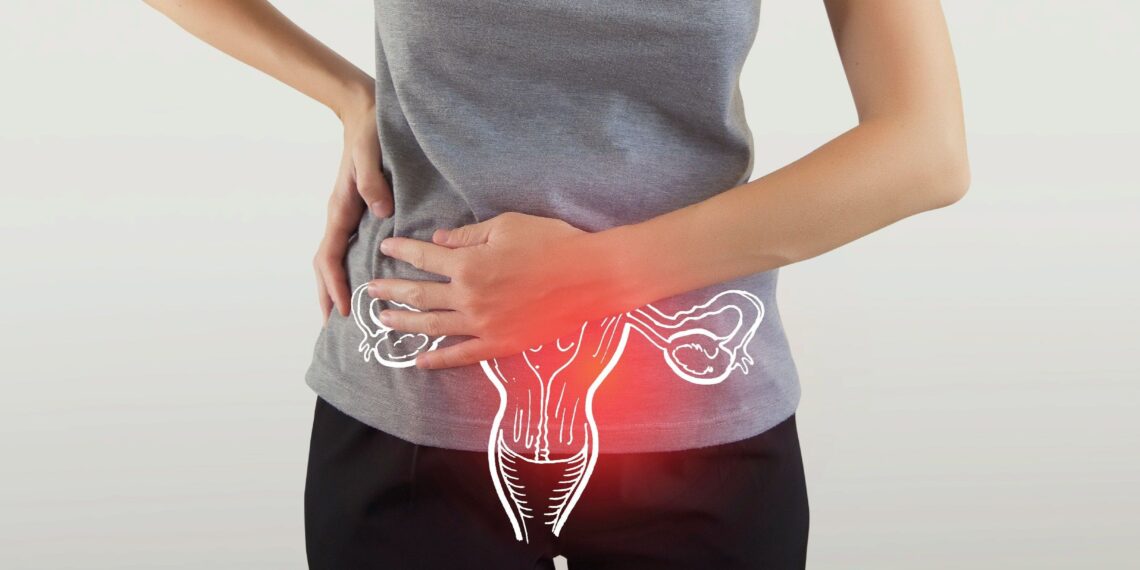 PCOS affects 44 million women in India, Kashmir reports alarming 30% prevalence: Study