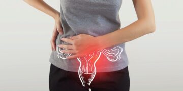 PCOS affects 44 million women in India, Kashmir reports alarming 30% prevalence: Study